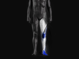 UNITLABS_PX2_Lymphatic drainage sleeve